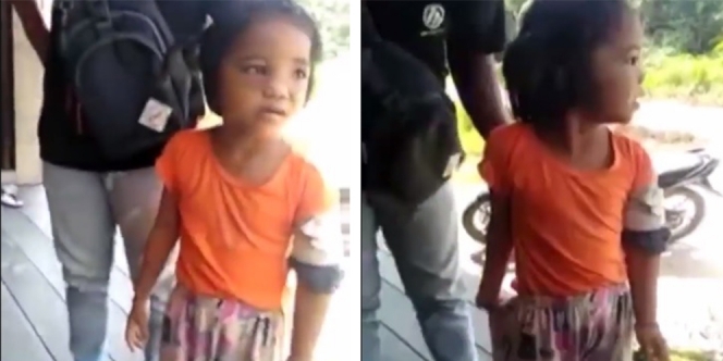 Dihajar Ibu Kandung serta Ayah Tirinya, Gadis 5 Tahun Ini Mukanya Lebam dan Tangannya Patah