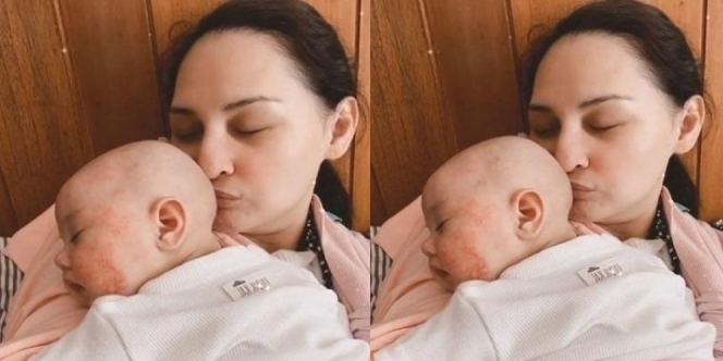 Baru Usia 3 Bulan, Bayi Mona Ratuliu Kena Dermatitis Atopik Kulitnya Merah Sampai Berair