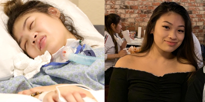 Sempat Koma Selama 14 Bulan karena Kesalahan Operasi Payudara, Remaja Ini Akhirnya Meninggal Dunia
