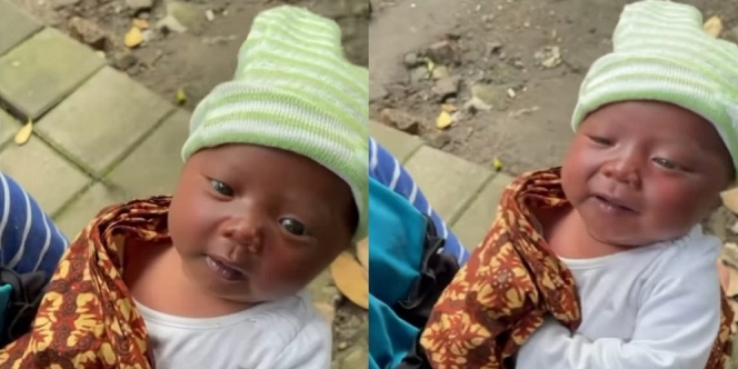 Sungguh Memilukan, Bayi Ini Wajahnya Sampai Gosong Akibat Hidup di Jalanan Bersama Orang Tua