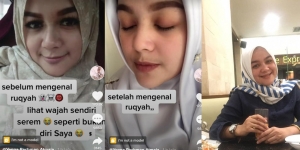 Deretan Fobia Para Artis Indonesia yang Unik, Mulai dari Takut Kerupuk hingga Nasi Kotak