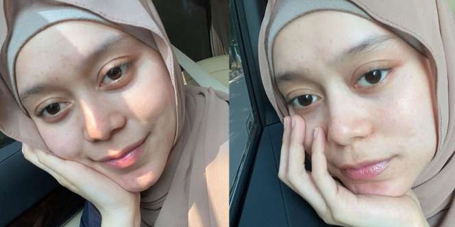 8 Potret Lesti Kejora Tanpa Make Up, Bukti Kecantikan Alaminya Selalu Terpancar