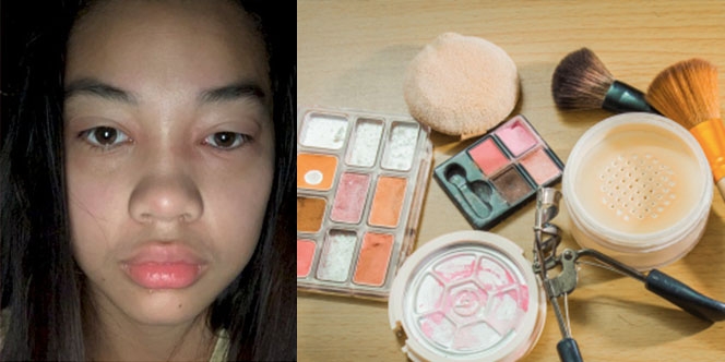 Pakai Makeup Kadaluwarsa, Wajah Wanita Ini Bengkak dan Bernanah