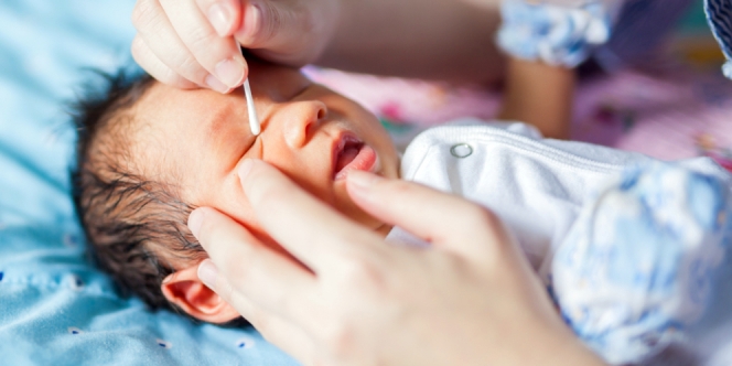 Mata Lengket dan Belekan pada Bayi Baru Lahir, Normal atau Tanda Bahaya?