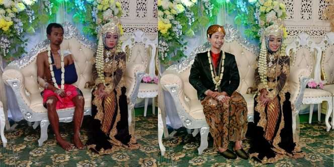 Viral Pengantin Pria Hanya Koloran karena Penuh Luka, Ini Sederet Editan Netizen yang Bikin Salut