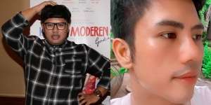Perbandingan Gaya Ricky Cuaca Dulu dan Sekarang Setelah Turun 60 Kg dan Operasi Hidung