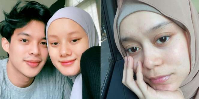 Sudah Jadi Istri, Ini 7 Adu Gaya Dinda Hauw dan Lesti Kejora Tanpa Make Up