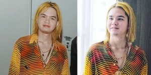 Potret Terbaru Dul Jaelani dengan Rambut Warna Kuning, Tissa Biani: Gantengnya Pacarku...