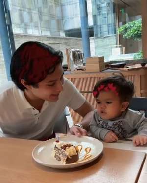 Ini 10 Potret Adik Teuku Rassya yang Memiliki Sindrom Dwarfisme dan Jarang Diekspose