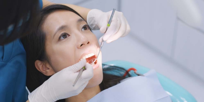 Sederet Mitos dan Fakta Scaling, Benarkah Bisa Putihkan Gigi?