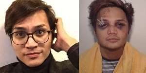 Beredar Foto Terbaru Reynhard Sinaga, Memar dan Babak Belur