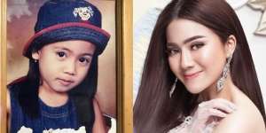 Pernah Diejek sampai Pindah Sekolah 3 Kali, Ini Potret Masa Kecil Felicya Angelista