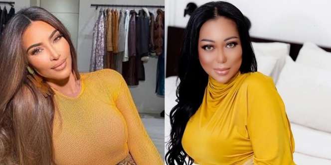 Terobsesi Mirip Kim Kadarshian, Ini 7 Potret Terbaru Natha Narita Eks Duo Racun Pasca Operasi