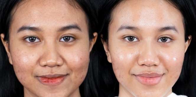 Mengaku Insecure, Ini 10 Potret Mayang Luciana Usai Lakukan Perawatan Wajah Rp80 Juta