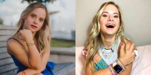 8 Potret Cantik Sofia Jirau, Model Down Syndrome Pertama yang Digandeng Victoria's Secret