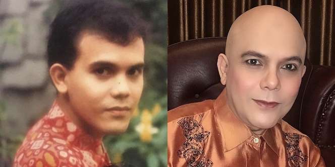 Potret Transformasi Ozy Syahputra 'Si Manis Jembatan Ancol', Dulunya Sempat Punya Rambut!