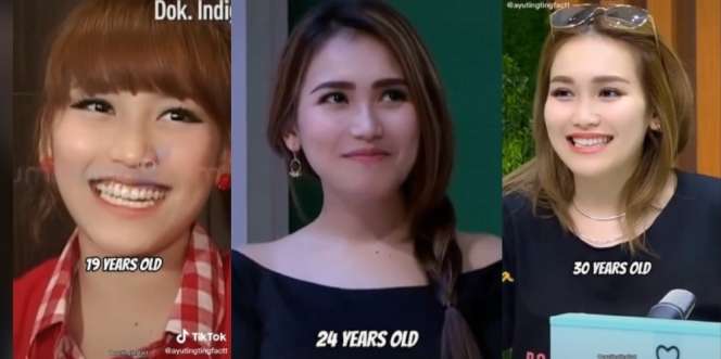 13 Potret Ayu Ting Ting yang Berdandan Ala Idol K-Pop Sejak Awal Karir, Disebut Pedangdut Pertama yang Bergaya Korea