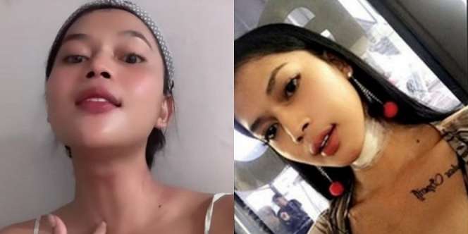 10 Momen Dinda Syarif Akui Lakukan Operasi Penghilangan Jakun, Sisa Tulangnya Masih Disimpan Hingga Kini