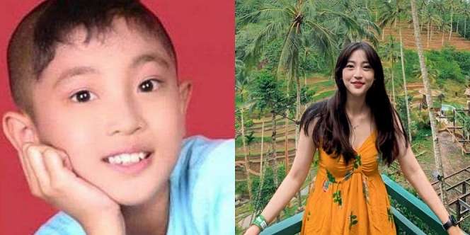 Dulu Botak Saat Jadi Ronaldowati, Ini Potret Terbaru Nona Berlian yang Kini Makin Cantik dan Feminin