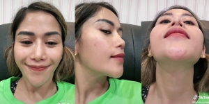 Operasi 3 Kali, Ini 10 Potret Terbaru Farida Nurhan yang Hidungnya Disebut Gagal Oleh Netizen