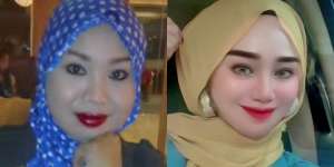 Viral Perempuan Ini Wajahnya Berubah Banget Usai Glow Up, Bikin Pangling Kayak Beda Orang