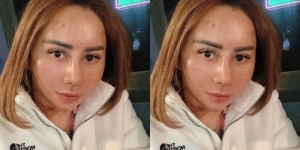 Akhirnya Buka Masker, Begini Kondisi Wajah Femmy Permatasari Setelah Jalani Oplas di Korea