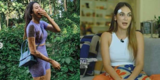 Deretan Artis Tanah Air yang Pernah Alami Kecelakaan Sepeda, Anya Geraldine Sampai Berdarah-darah!