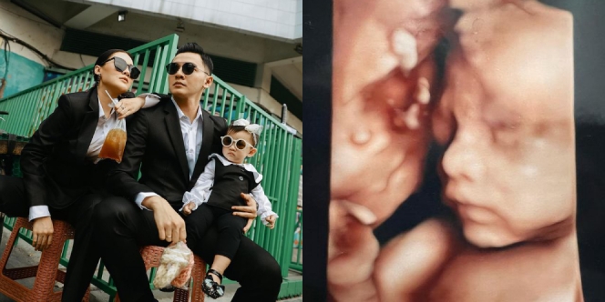 Nella Kharisma dan Dory Harsa Posting Potret USG Anak Kedua, Hidung Mancungnya Bikin Salfok!