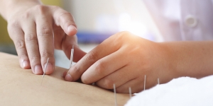 Obati Sakit Punggung dengan Akupuntur, Amankah untuk Kesehatan?