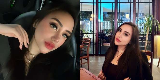 Deretan Potret terbaru Salmafina Sunan dengan Bibir yang Makin Tebal, Wajahnya Langsung Terlihat Beda!