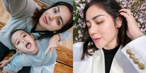 Deretan Potret Terbaru Jessica Iskandar Usai Operasi Plastik, Makin Percaya Diri Pamer Hidung Baru!