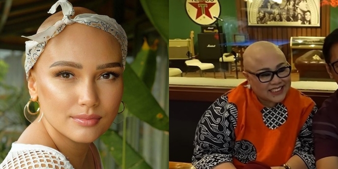 Selain Nunung, Ini Deretan Selebriti Wanita Indonesia yang Tampil dengan Kepala Plontos Usai Kemoterapi Kanker