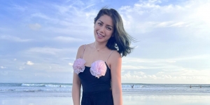 Jessica Iskandar Posting Wajah Habis Oplas, Auto Diserbu Komentar Netizen