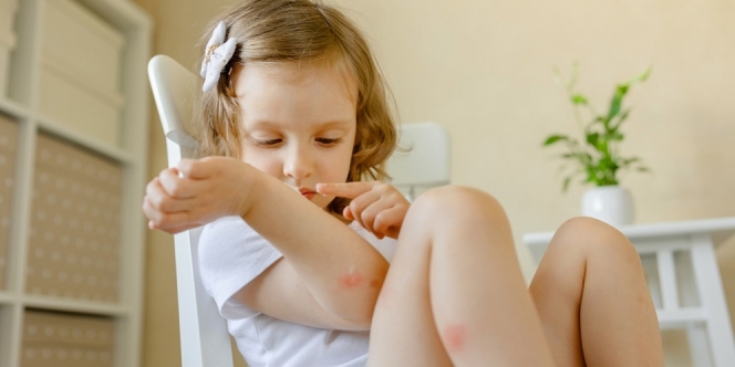 6 Cara Mengusir Nyamuk dengan Bawang Putih, Dijamin Ampuh!