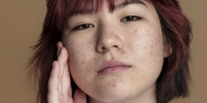 10 Cara Hilangkan Bruntusan di Wajah dan Skincare yang Cocok Digunakan