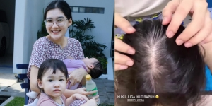 Pengorbanan Nella Kharisma Usai Lahirkan Dua Anak, Rambutnya Jadi Rontok Sampai Kelihatan Botak