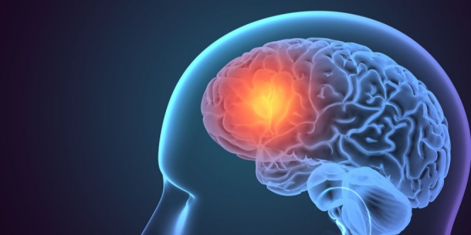 Mengenal Penyakit Mati Batak Otak, Penyebab, Dampak Hingga Cara Mencegahnya