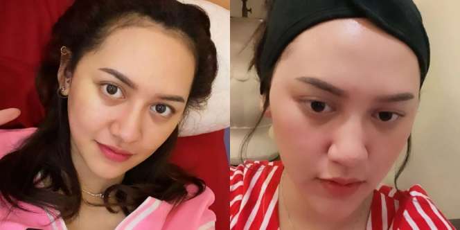 Ngaku Sering Suntik Vitamin C, Ini 10 Potret Happy Asmara yang Tetap Glowing Meski No Make Up