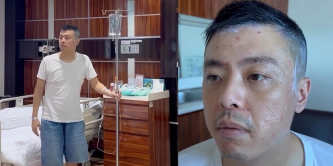 Kapten Vincent Raditya Kabarkan Terkena Flu Singapura, Wajah Bentol-Bentol Sampai Bernanah
