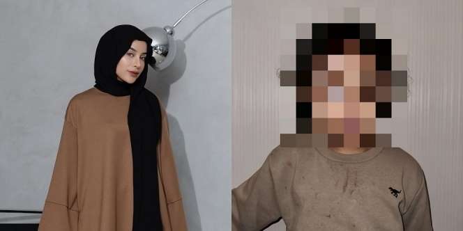 Anak Selebgram Emy Aghnia Punjabi Alami Kekerasan Hingga Lebam, Pelaku Diduga Suster Sendiri