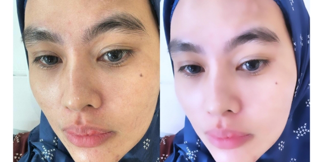 Pede Pamer Muka Berjerawat, Kartika Putri Sebut Sang Suami Lebih Suka Lihat Wajahnya Tanpa Makeup
