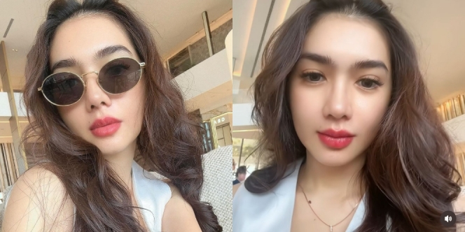 7 Foto Terbaru Angel Karamoy After Oplas di Korea Selatan, Hidung Mancung Tuai Pro-Kontra Netizen