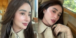 Dewi Perssik Tolak Tawaran Endorse Rp1 Miliar untuk Operasi Hidung, Apa Alasannya?