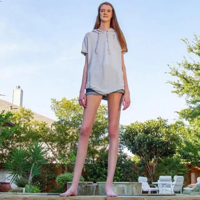 Tinggi Badan Lebih dari 2 Meter, Ini Potret Wanita yang Miliki Kaki Terpanjang di Dunia