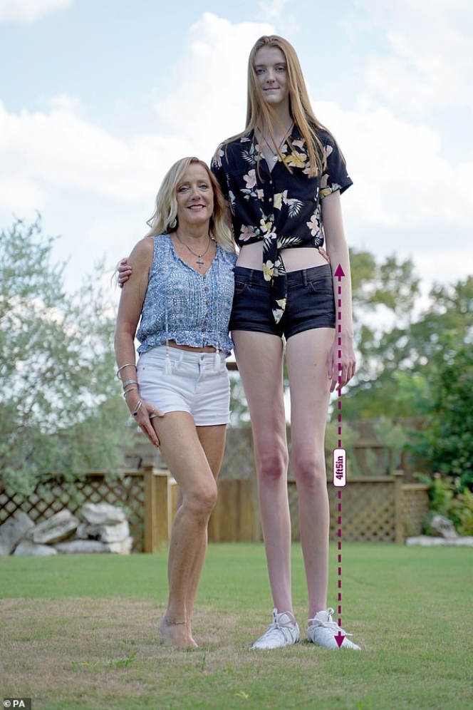 Tinggi Badan Lebih dari 2 Meter, Ini Potret Wanita yang Miliki Kaki Terpanjang di Dunia