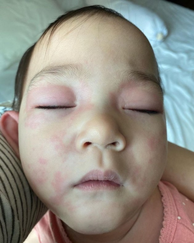 10 Potret Baby Numa Anak Mona Ratuliu yang Kena Alergi Makanan