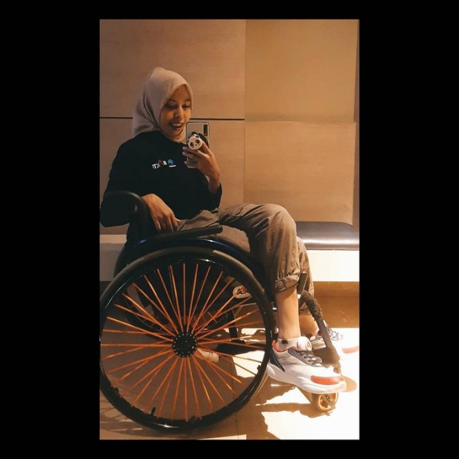 Potret Echi Pramitasari, Model Indonesia Penyandang Disabilitas yang Dobrak Standar Kecantikan 