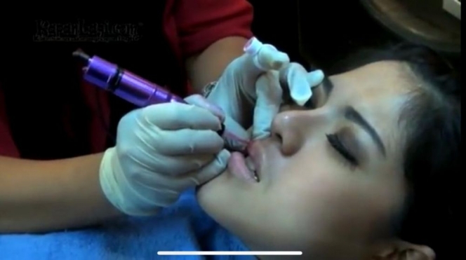 Botox Sampai Tanam Benang, Ini 7 Perawatan Kecantikan Tina Toon yang Bikin Wajahnya Manglingi