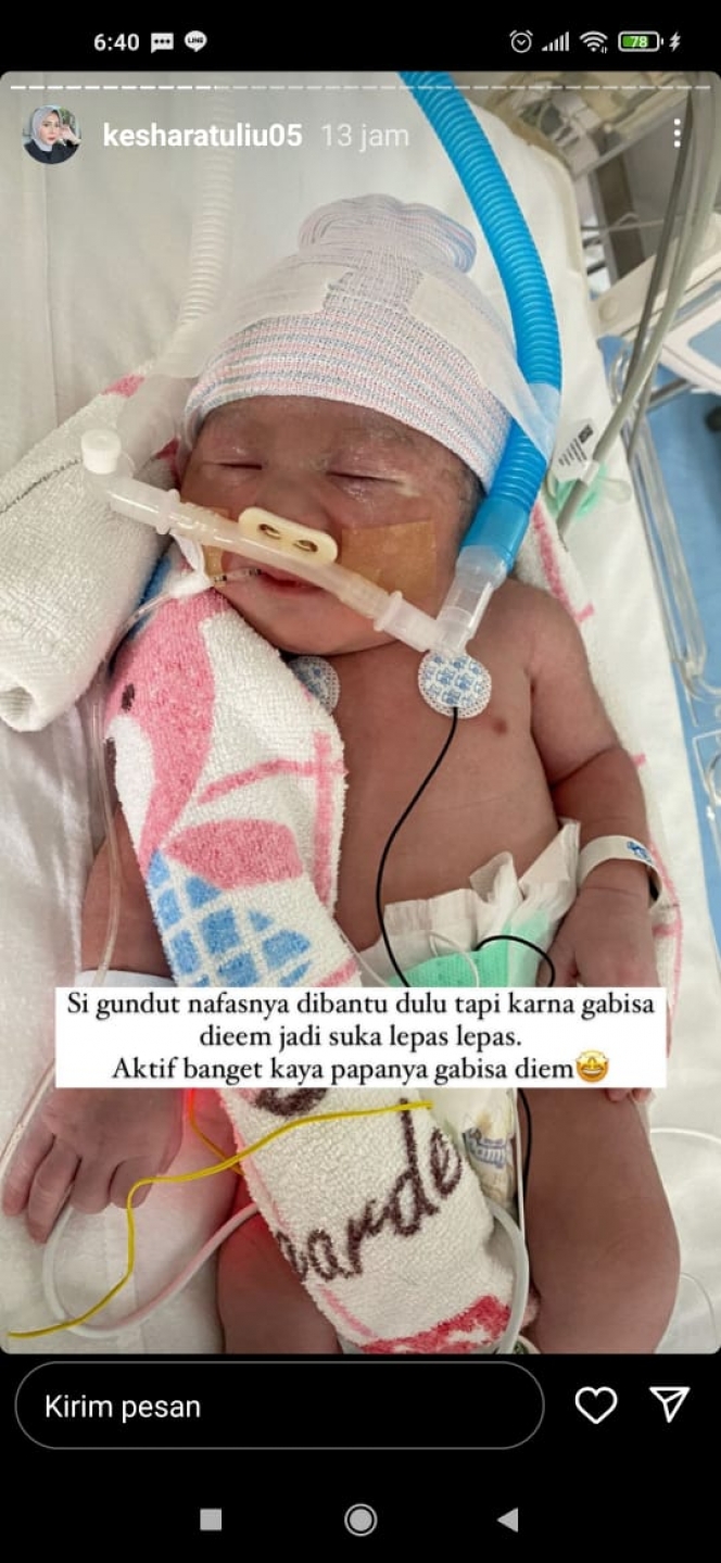 Potret Baby Qwenzy, Anak Kehsa Ratuliu yang Pakai Alat Bantu Pernapasan karena Napas Terburu-buru