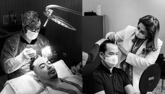 Makin Stylish, Ini 10 Potret Terbaru Dave Hendrik Pasca Transplantasi Rambut